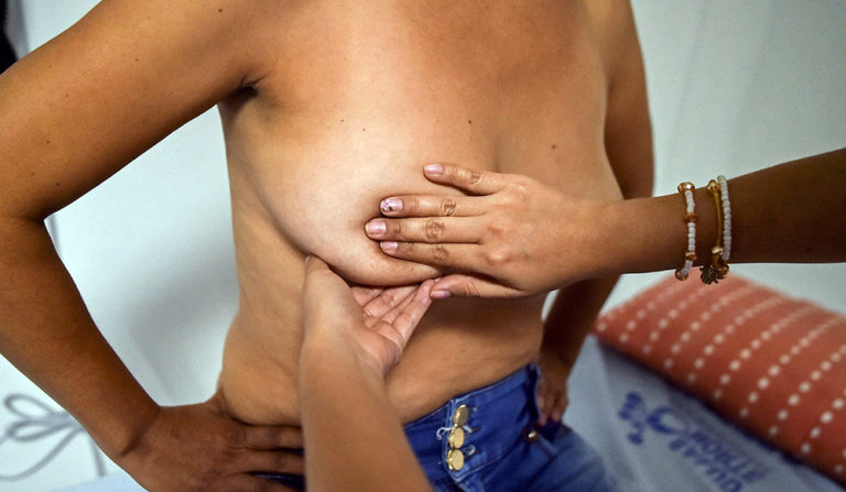 In Uruguay, breast cancer is the most frequent oncological disease among the female population, causing two deaths per day